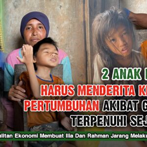 2 Anak Petani Alami Cacat Pertumbuhan
